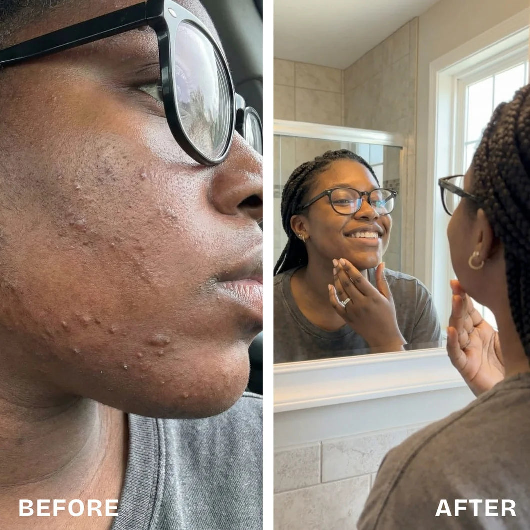 Renovia™ Cyperus Rotundus Oil