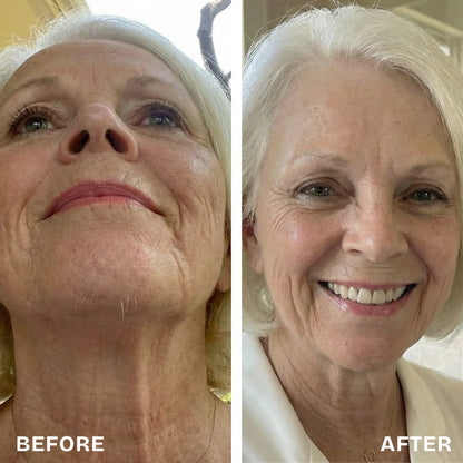 Renovia™ Cyperus Rotundus Oil