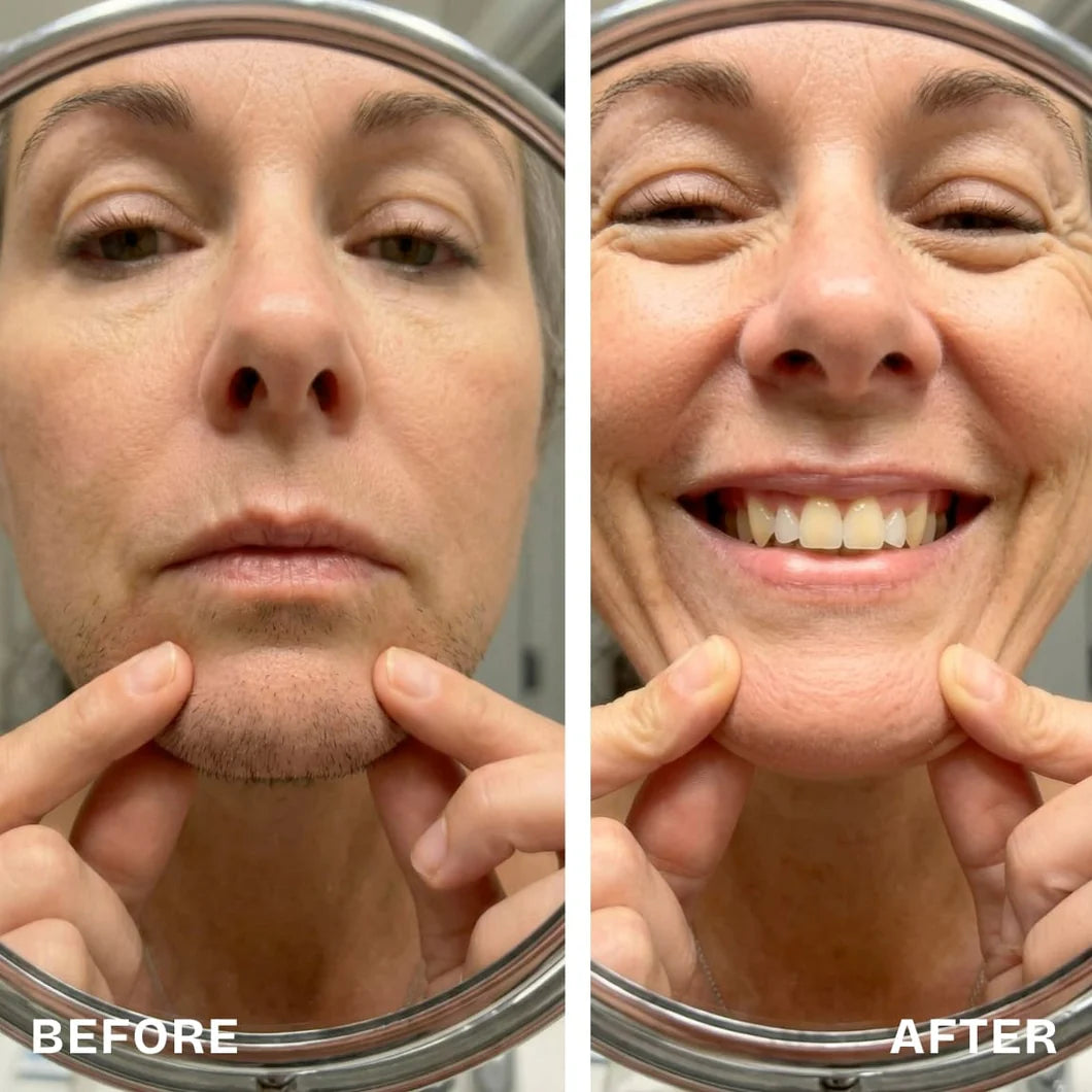 Renovia™ Cyperus Rotundus Oil