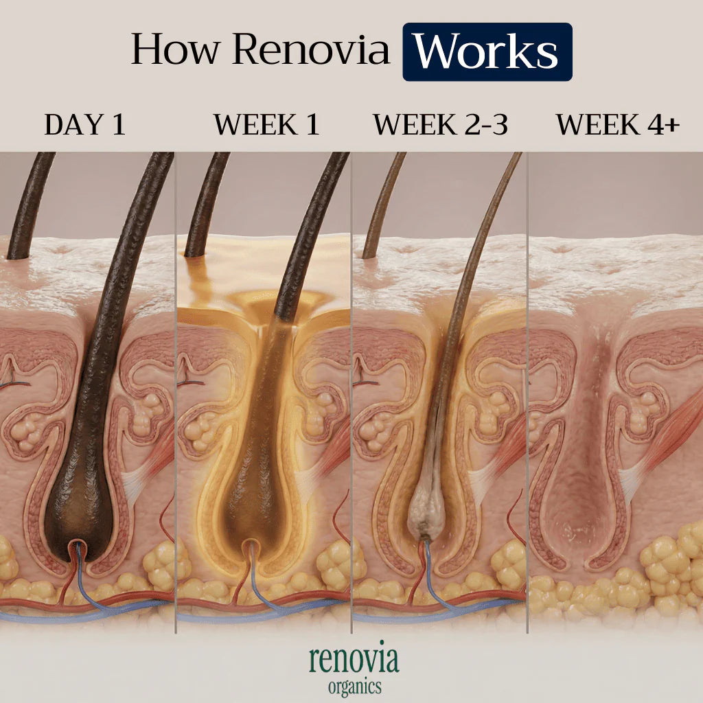 Renovia™ Cyperus Rotundus Oil