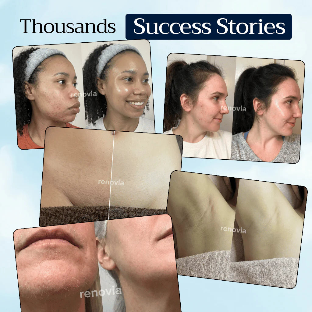 Renovia™ Cyperus Rotundus Oil